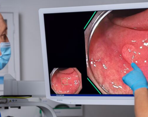 Olympus Corporation of the Americas | Olympus